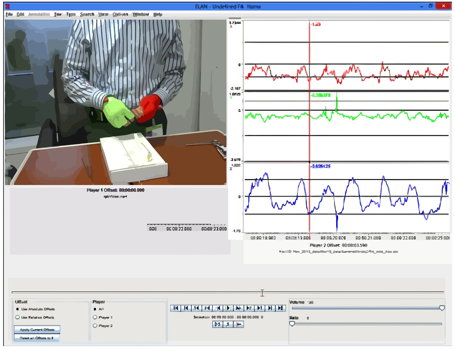 Video and Accelerometer-Based Motion Analysis for Automated Surgical Skills Assessment